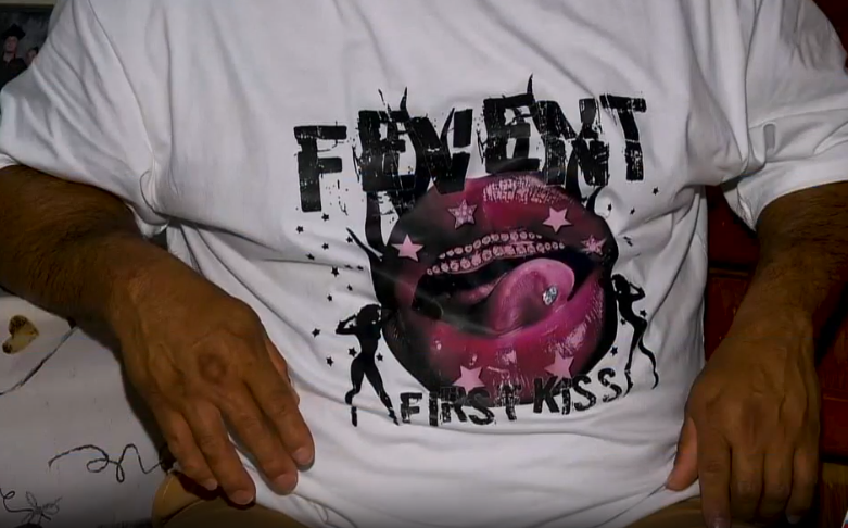 Víctima de brutal atropello en Cartago revela por qué fue embestido y muestra sus heridas