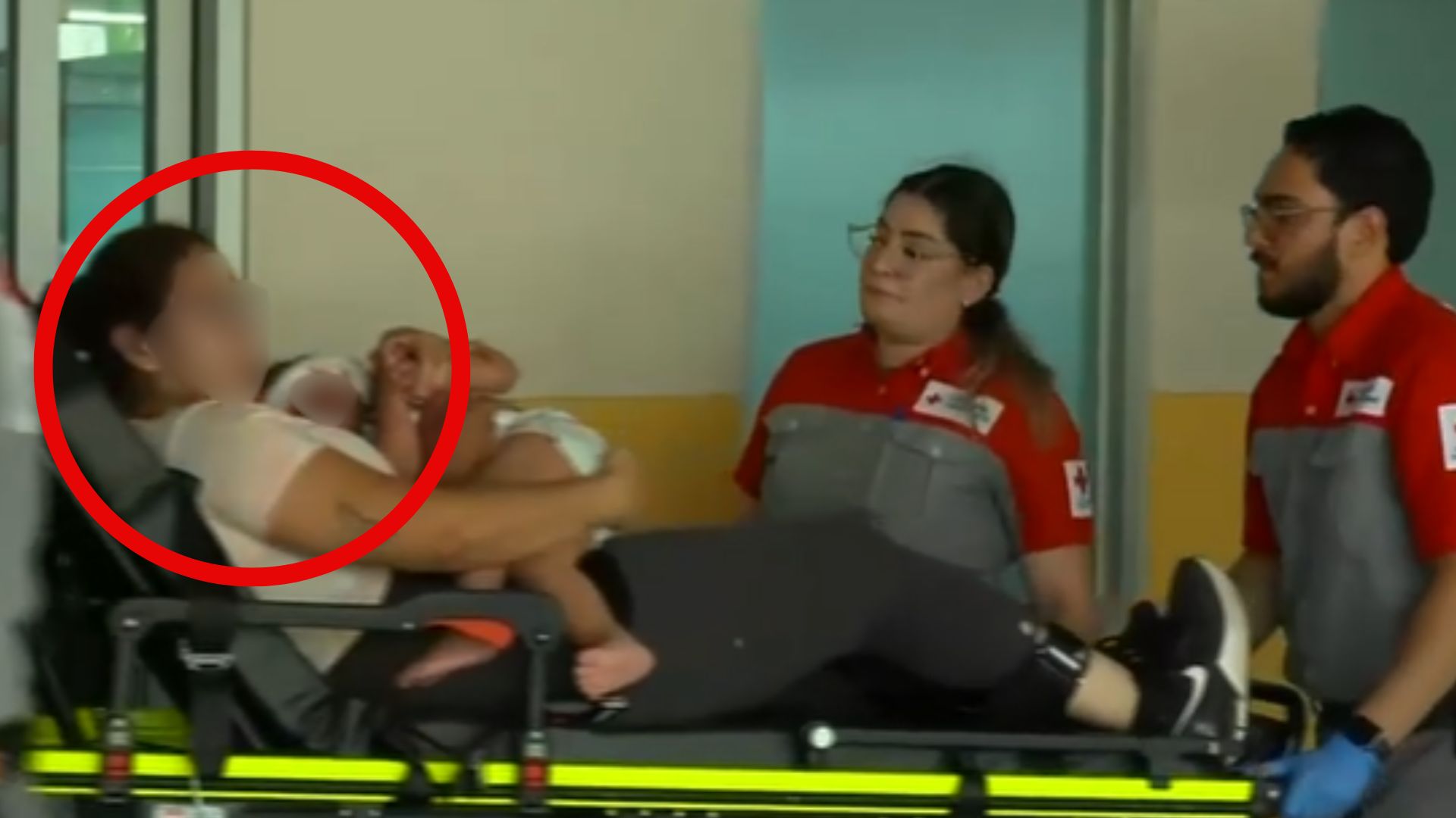 ¡Impactante escena! Así ingresó niña de 1 año a hospital tras ser atacada por un perro en el rostro