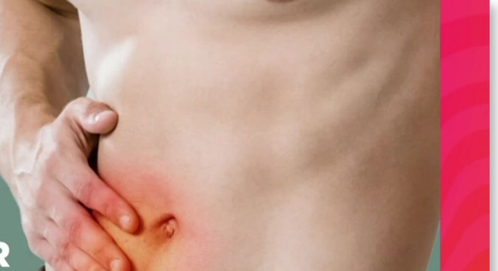 ¿Siente una “bolita” en el abdomen? Estas señales deberían encender sus alarmas
