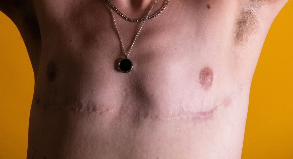 Heridas después de cirugías: Sustancias para una mejora en la cicatrización