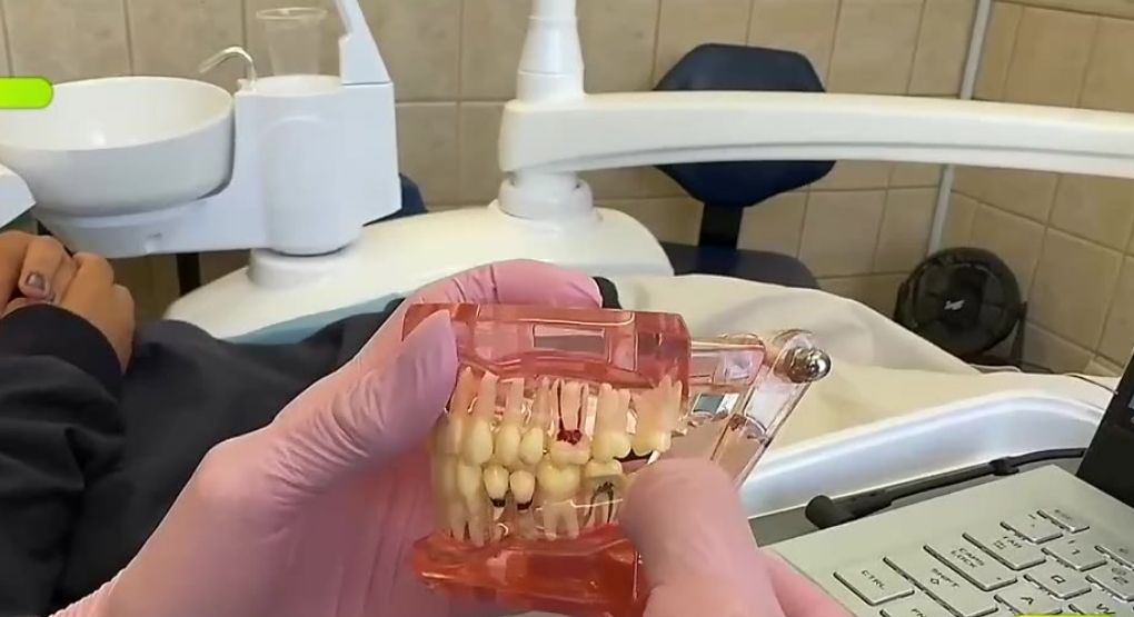 ¿Dolor tras extracción de cordales? Estos consejos le ayudarán a aliviarlo