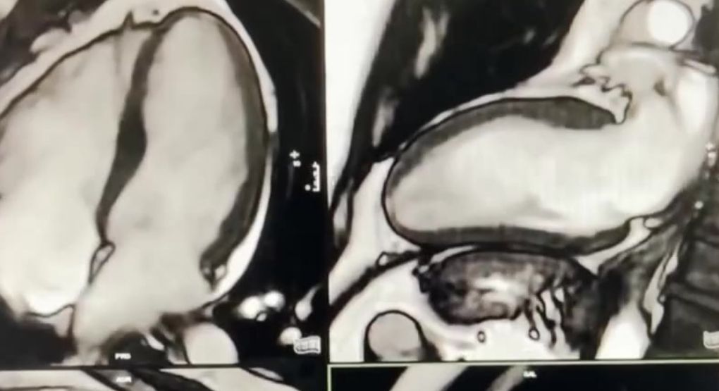Exámenes como ecocardiogramas, tac o resonancia son claves para diagnósticos: Descubra los cuidados previos