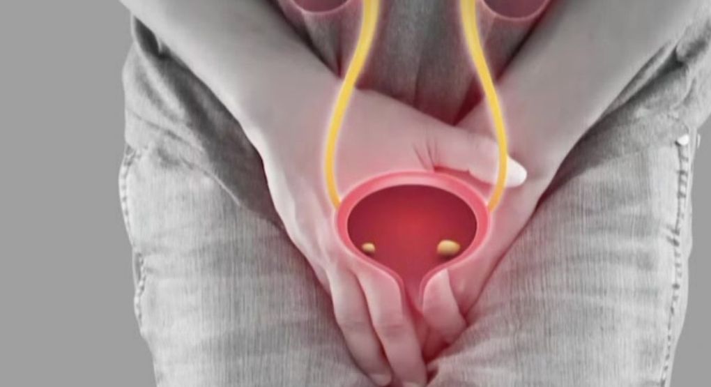 Cambios en la orina: señales de alerta que no debe ignorar