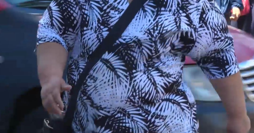 ¿Cuántos millones al año le cuesta a la CCSS los más de 400 pacientes con obesidad?