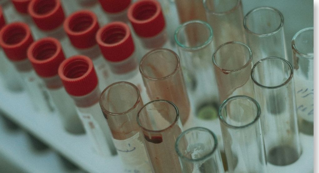 Conozca el proceso de las pruebas de sangre