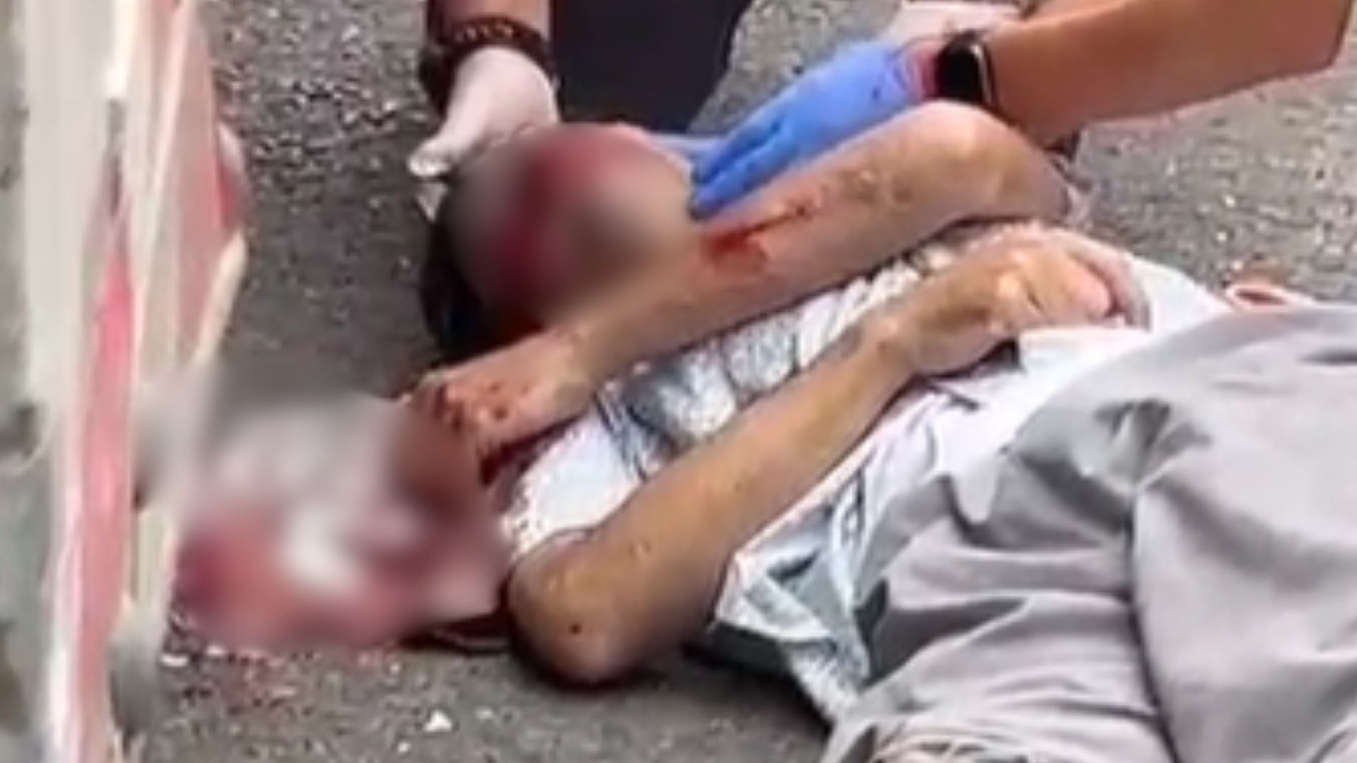 ¡Urgente! Aparatoso accidente de tránsito deja a hombre luchando por su vida