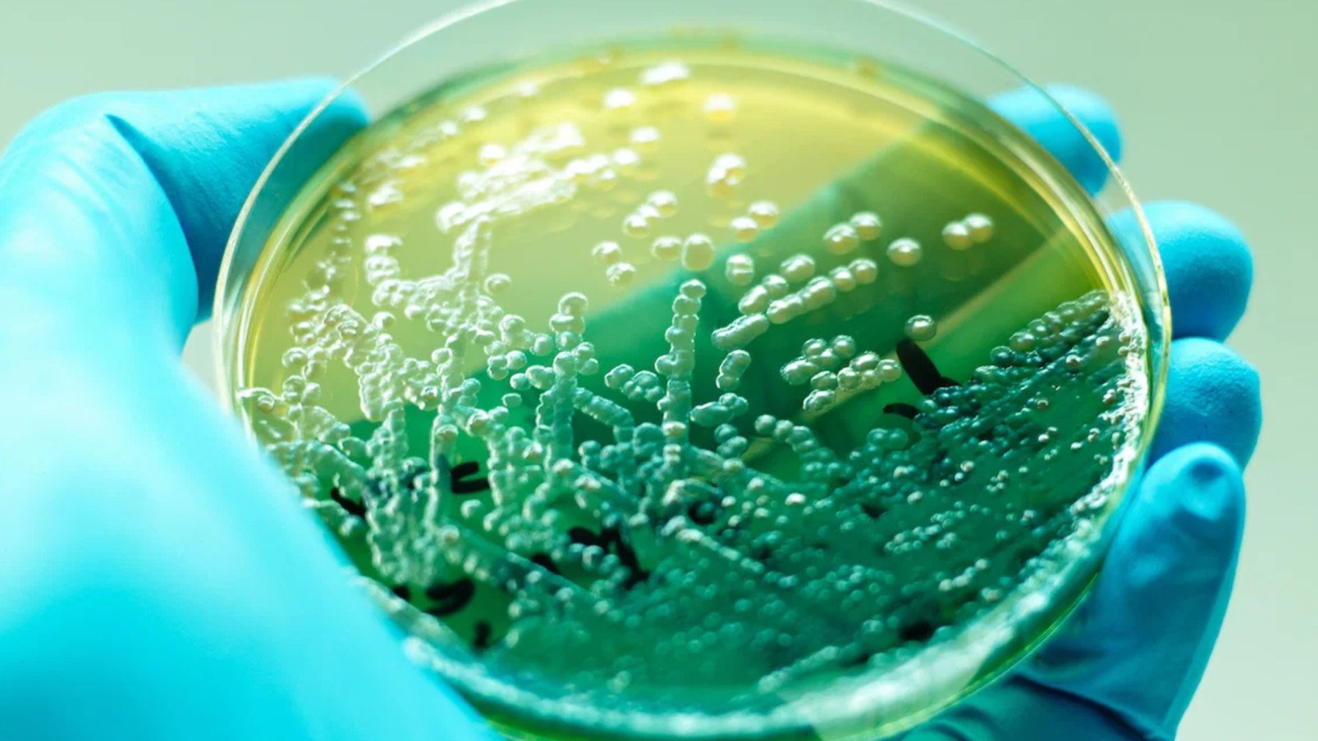 Brote de peligrosa bacteria obliga a cerrar unidad de quemados en hospital