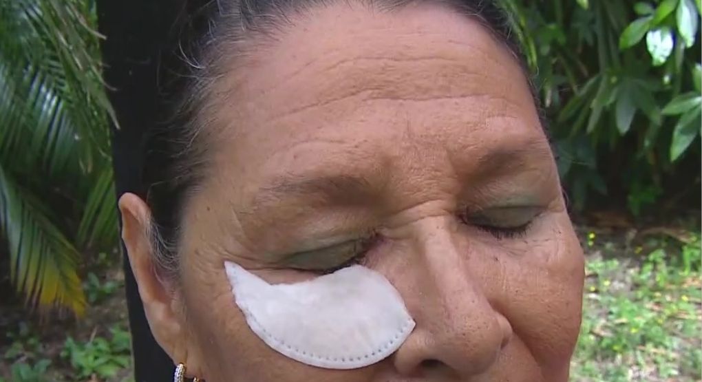 ¿Bolsas bajo los ojos? Experta explica posibles razones