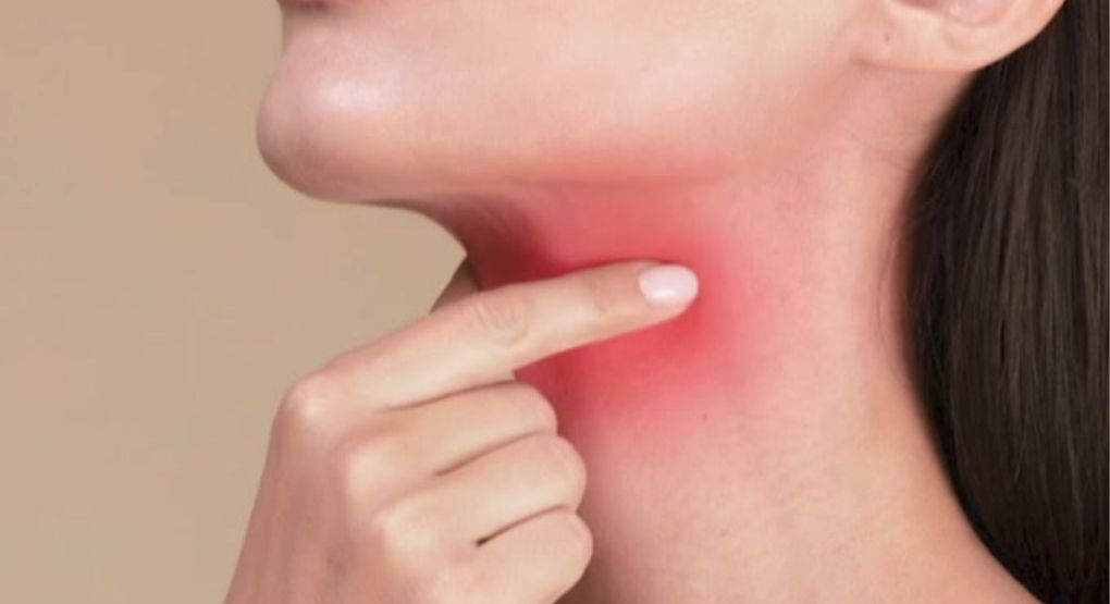 ¿Cómo diferenciar la amigdalitis de un virus? Experto lo aclara