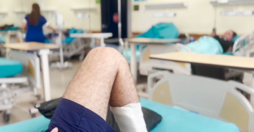 Tres personas en promedio sufren amputación por accidentes