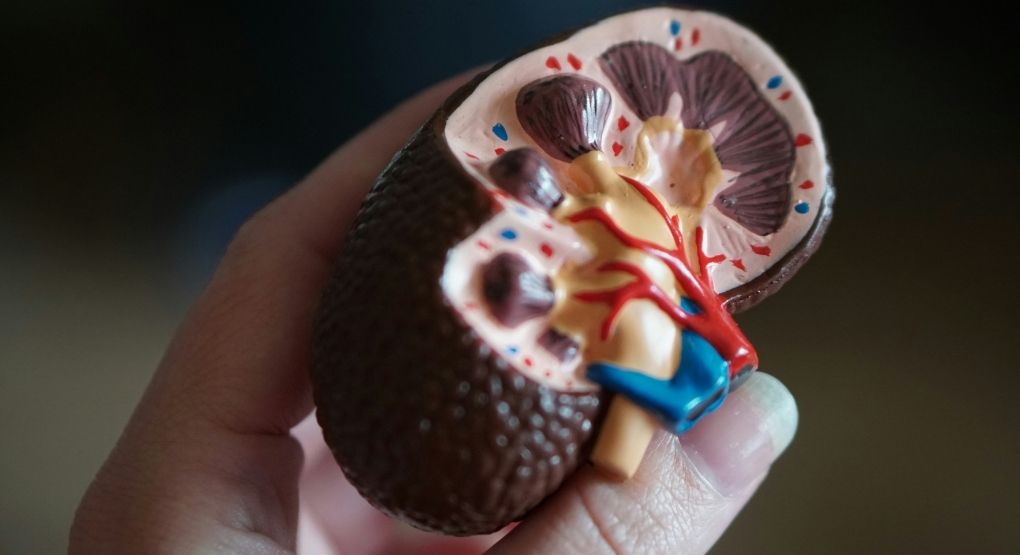 ¿Cómo identificar el dolor causado por piedras en 